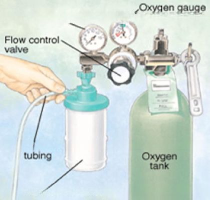 Installation Scheme of Oxygen Supply Pipeline in Medical Center Oxygen Supply System, Medical Oxygen System